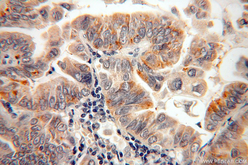 CAPSL Polyclonal antibody
