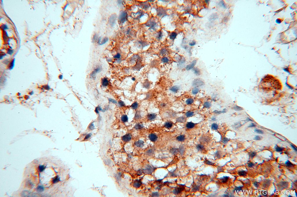 FUT11 Polyclonal antibody