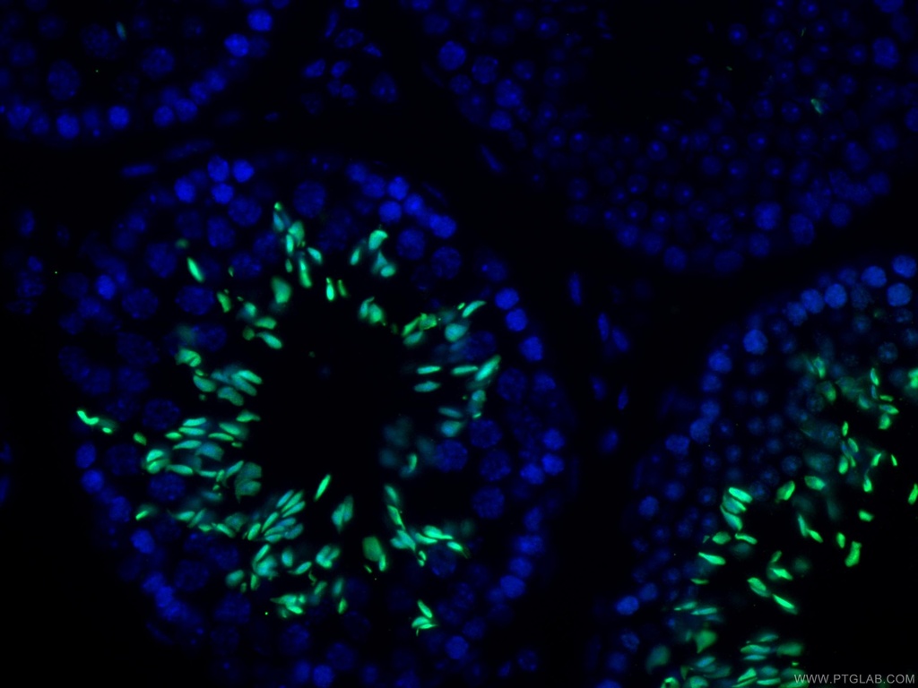 TNP1 Polyclonal antibody