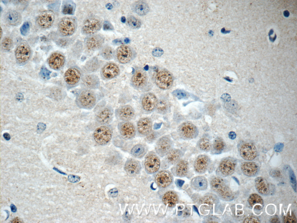 RALYL Polyclonal antibody