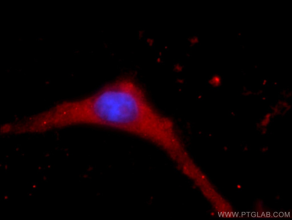 KCNN3 Polyclonal antibody