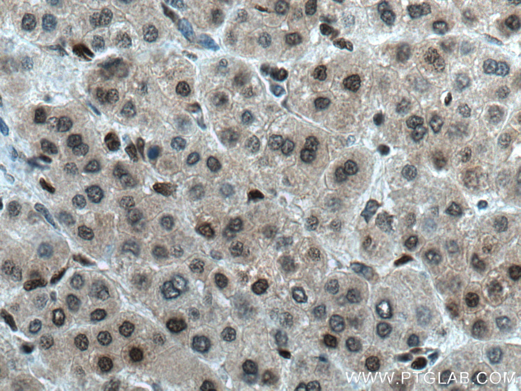 MGMT Polyclonal antibody