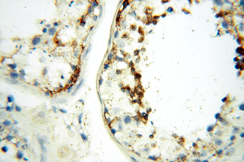 LYZL1 Polyclonal antibody