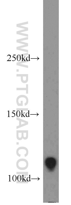 Rb Polyclonal antibody