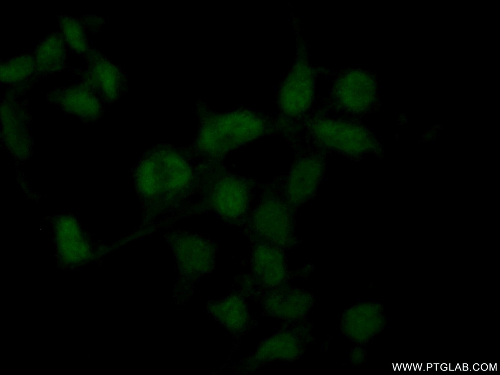 RBM11 Polyclonal antibody