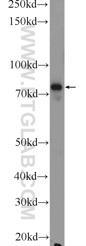 Factor XIIIa Polyclonal antibody