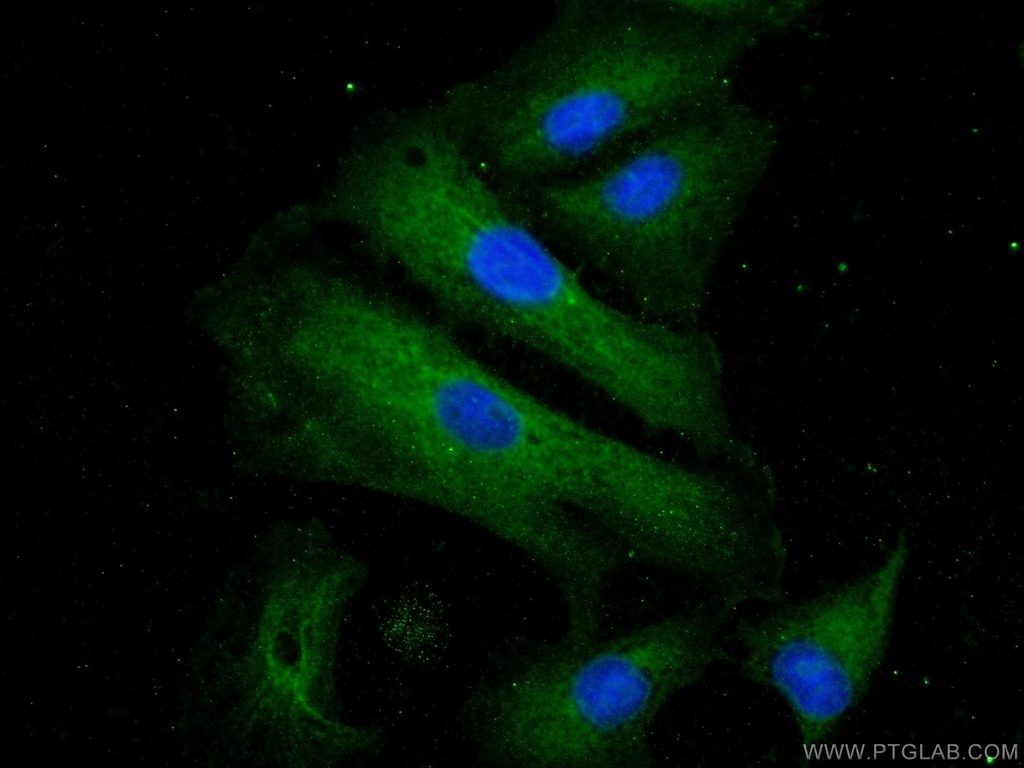 USHBP1 Polyclonal antibody
