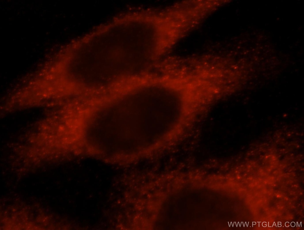 KLHL18 Polyclonal antibody