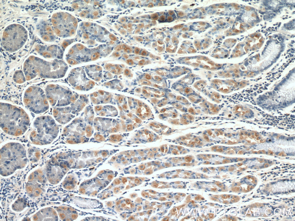 GDAP2 Polyclonal antibody