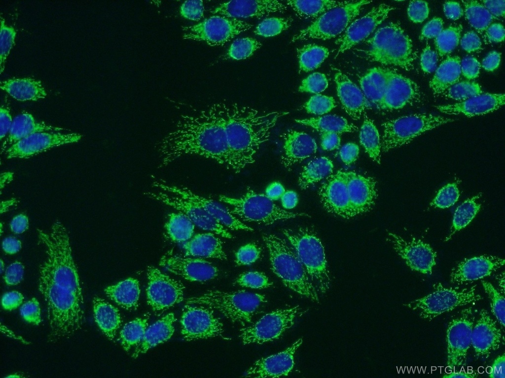 ATPB Polyclonal antibody