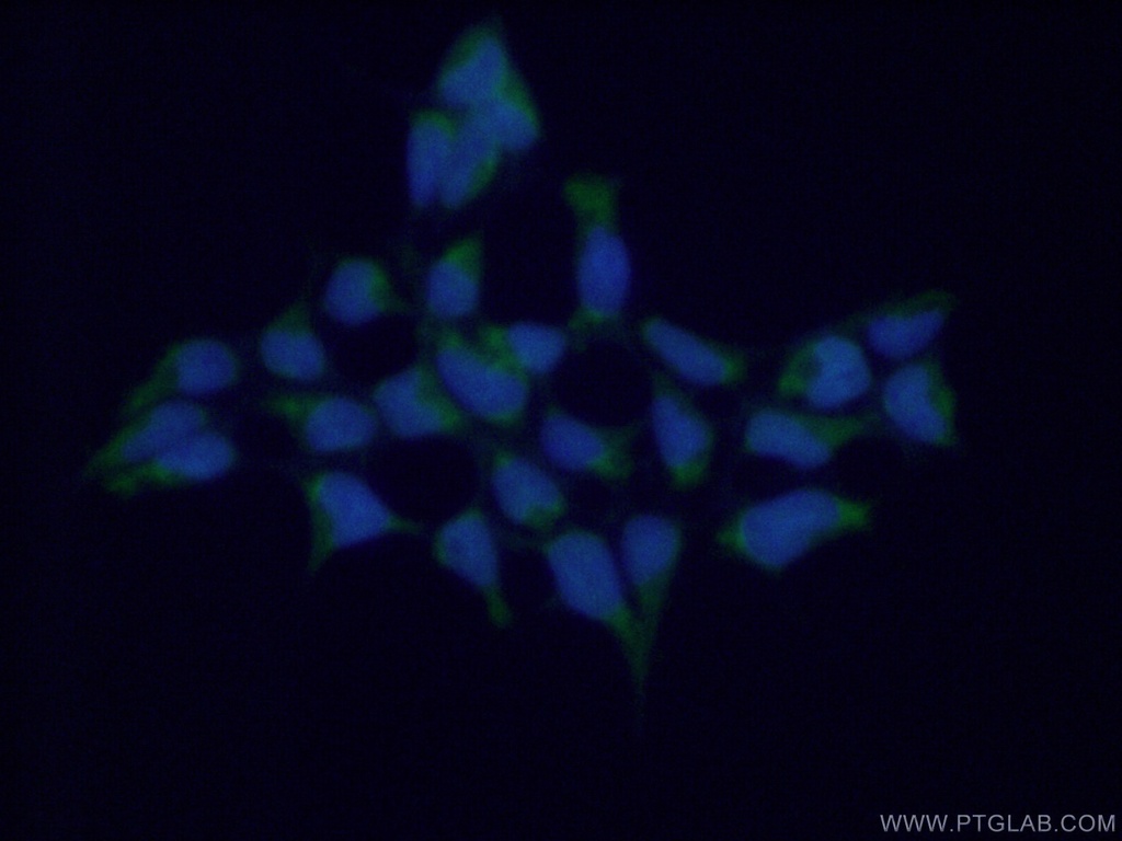GSTA4 Polyclonal antibody