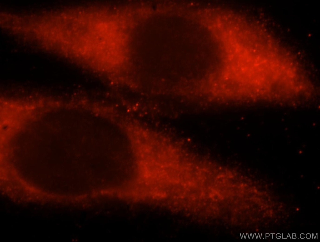 UBE2L6 Polyclonal antibody