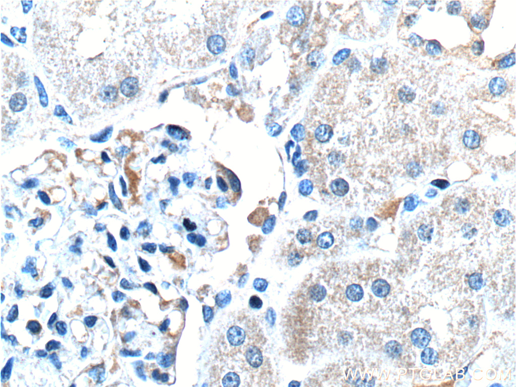 MT1M Polyclonal antibody
