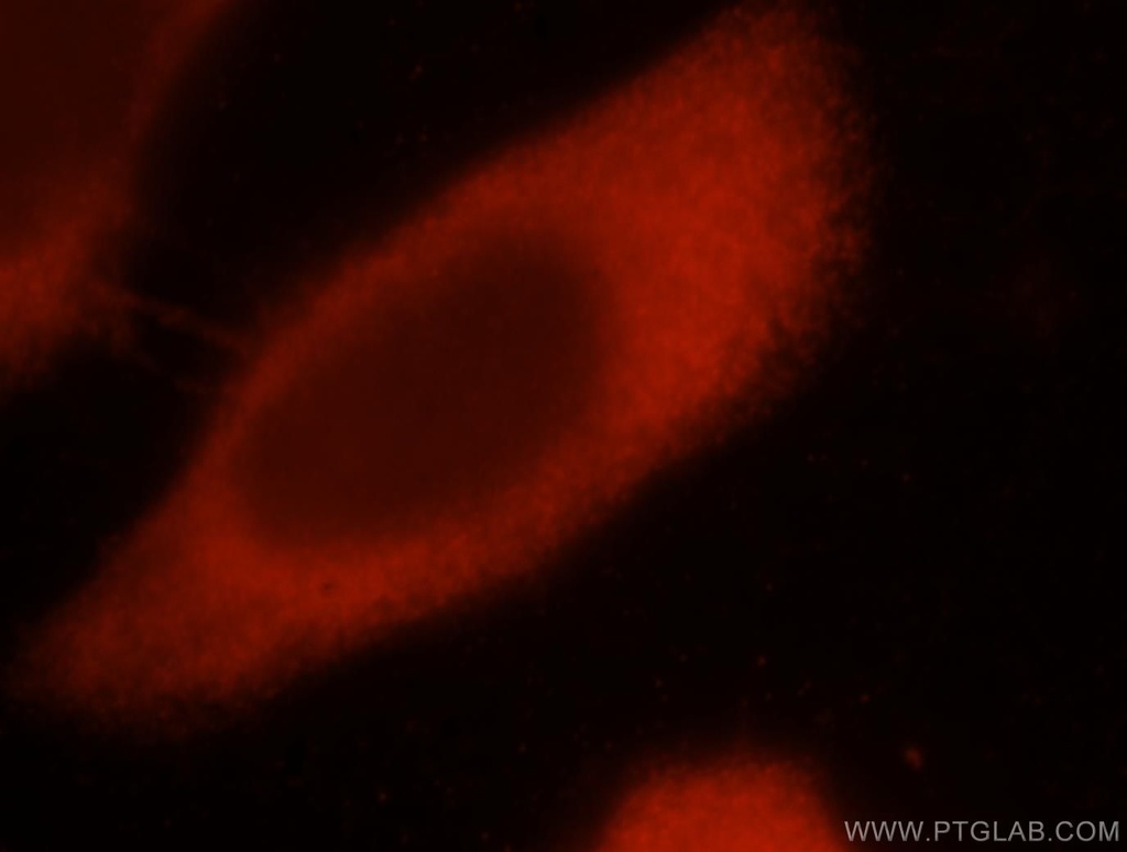 EIF4E3 Polyclonal antibody
