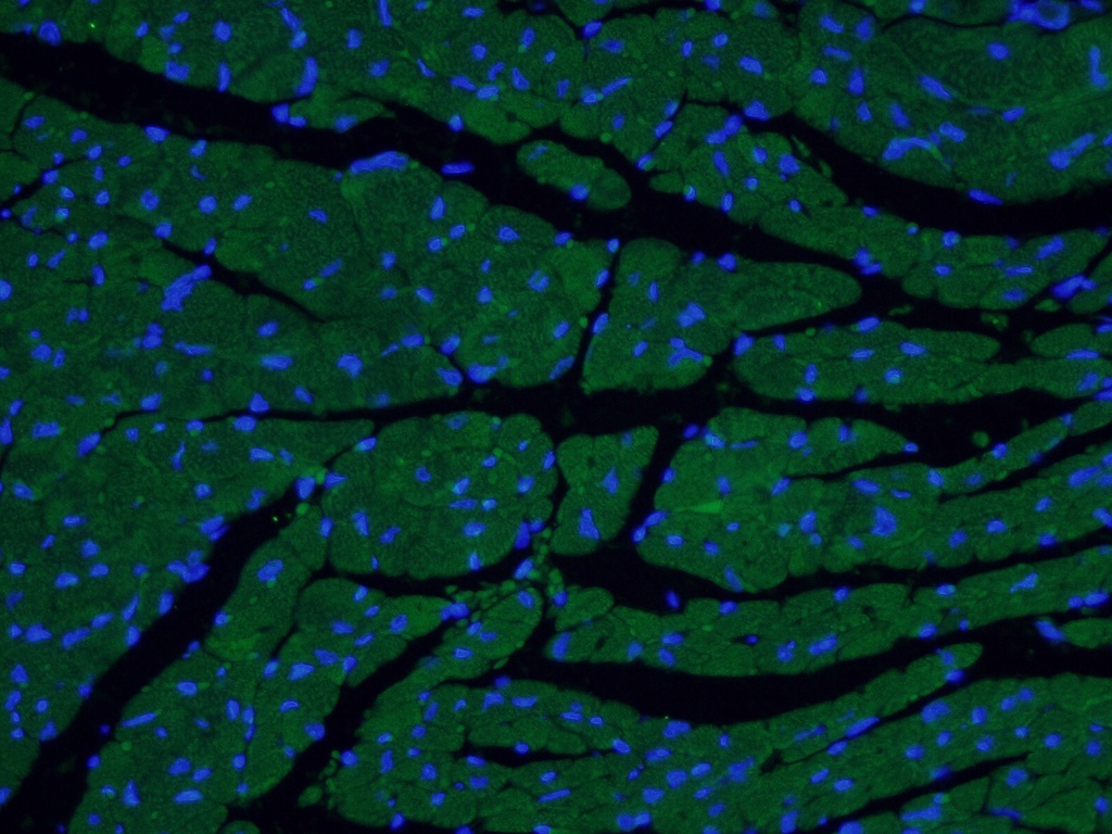 MYL7 Polyclonal antibody