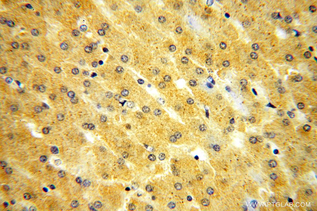 KIF6 Polyclonal antibody