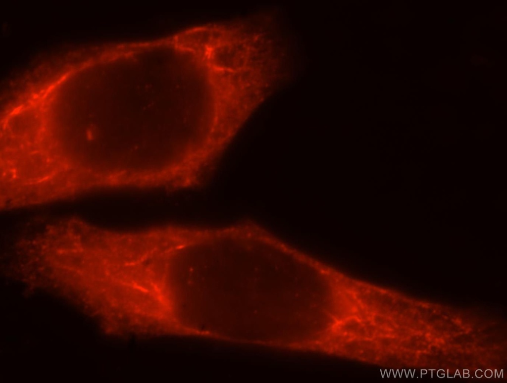 GIMAP7 Polyclonal antibody