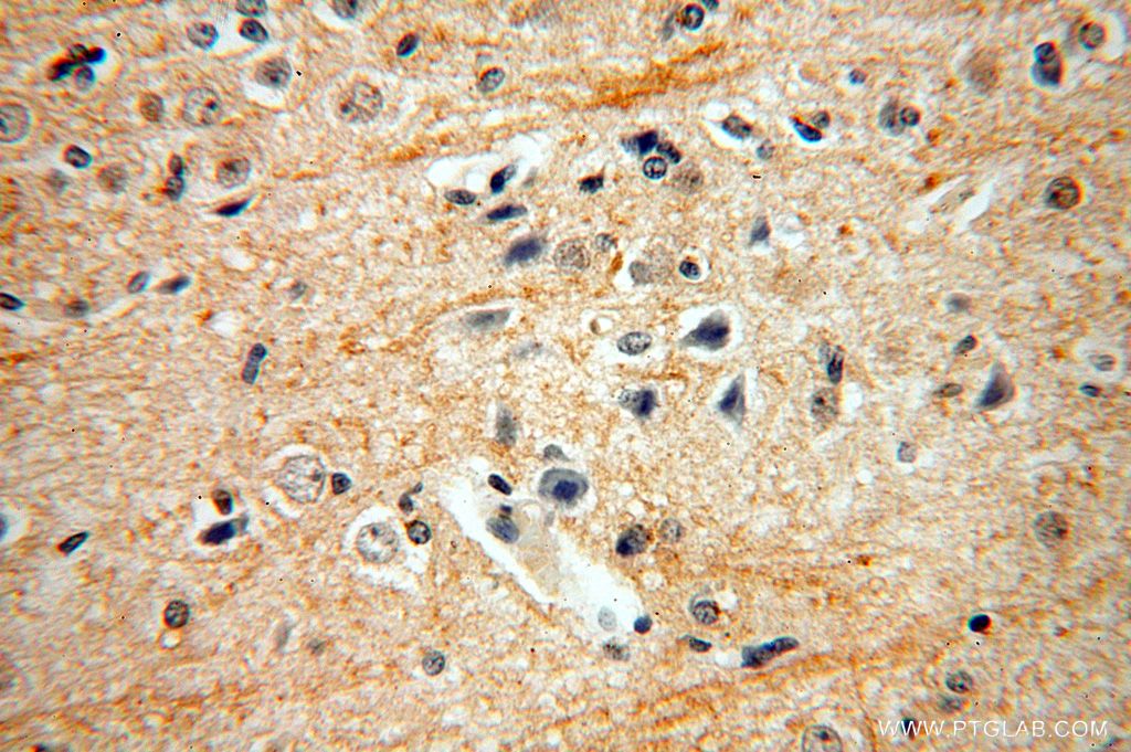 ENPP4 Polyclonal antibody