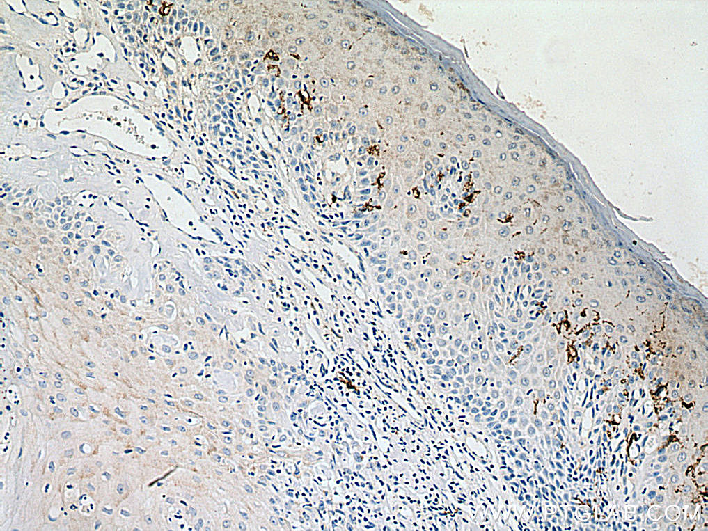 CD1a Polyclonal antibody