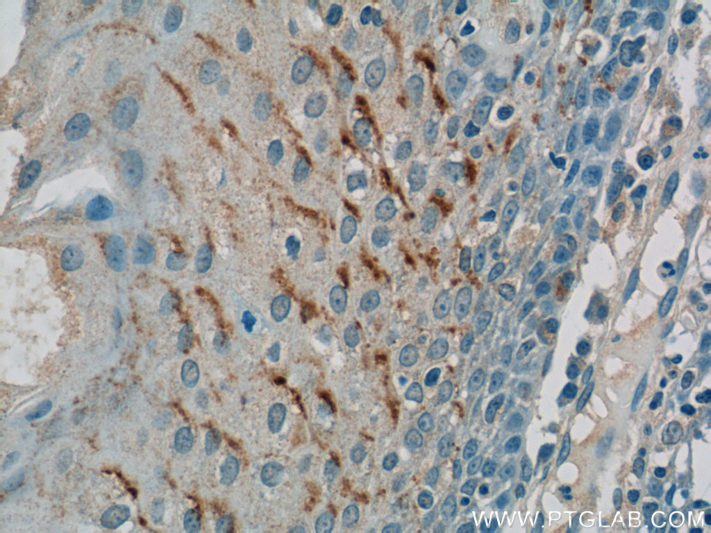 GSG1L Polyclonal antibody