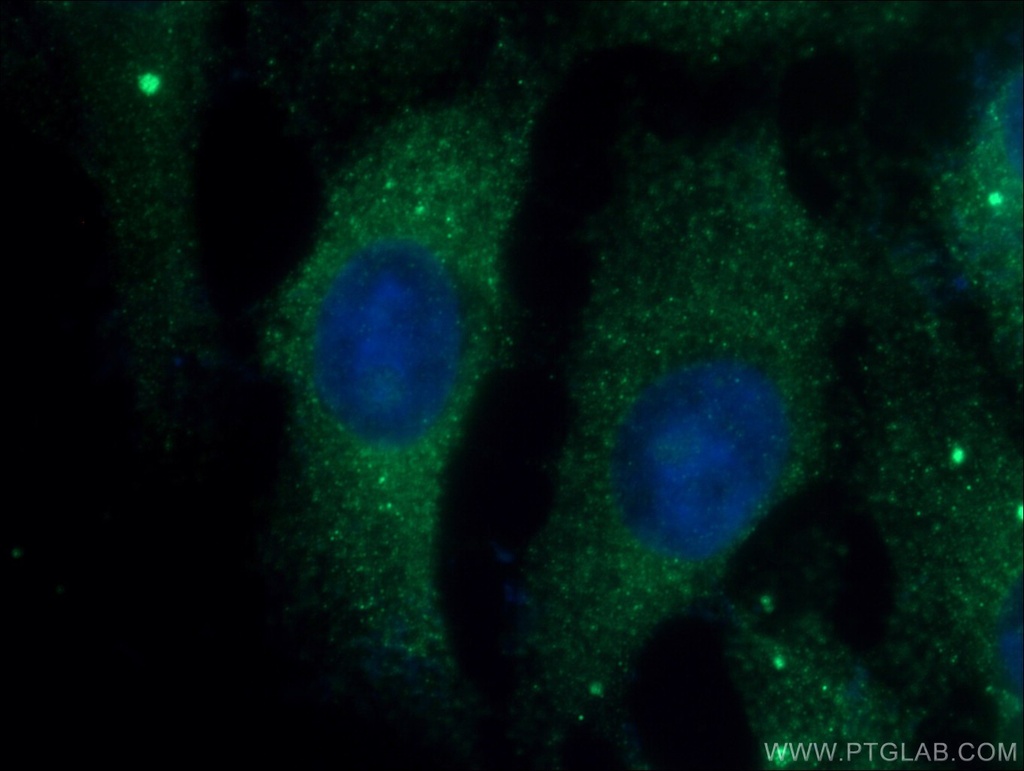 JNK2 Polyclonal antibody
