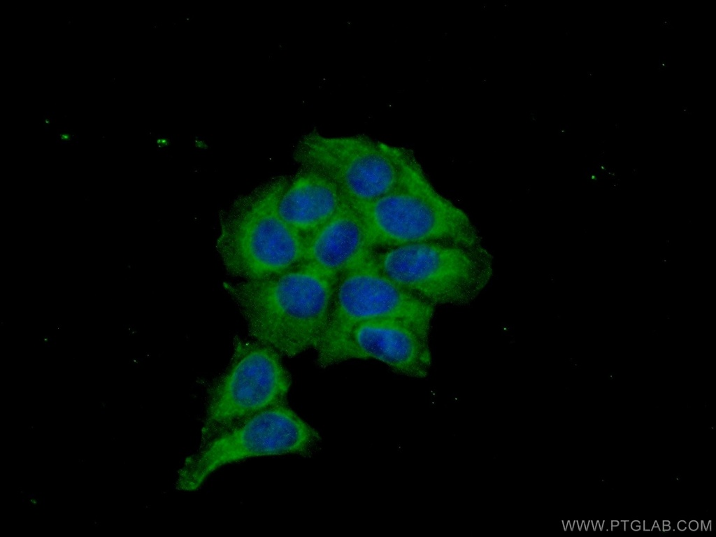 MKNK2 Polyclonal antibody