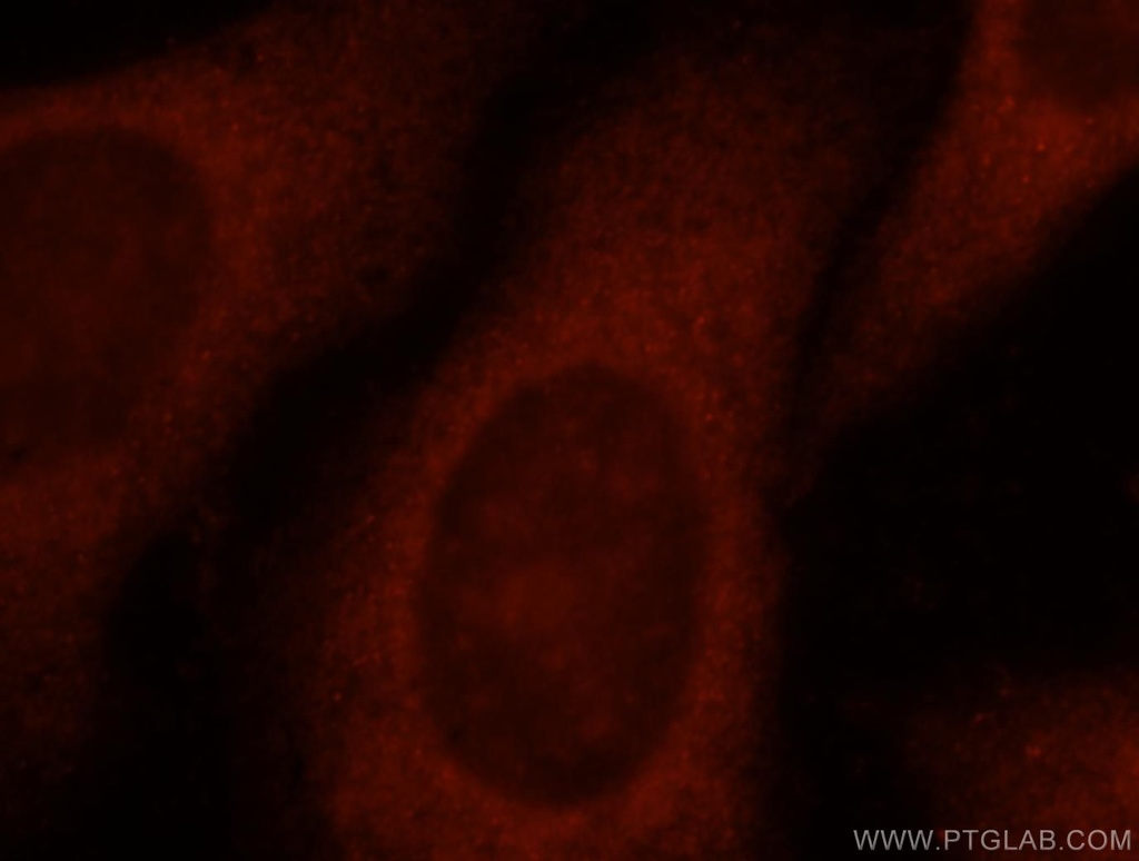 ACTL7A Polyclonal antibody
