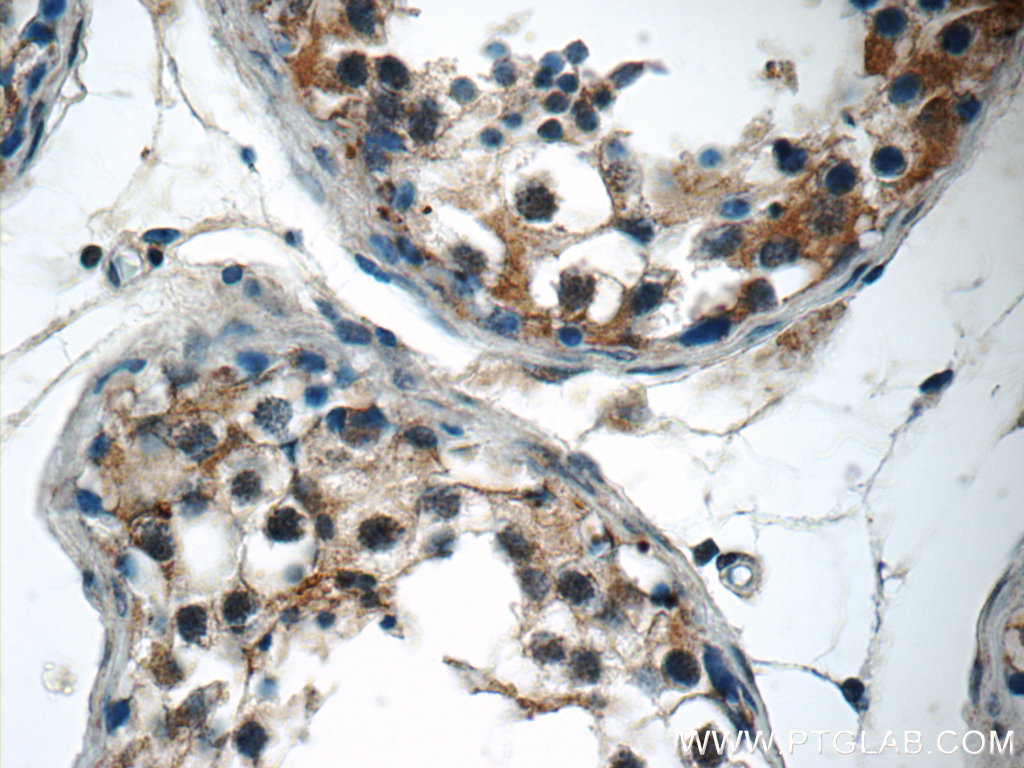 SPATA16 Polyclonal antibody