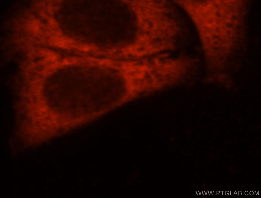 DNAJC5B Polyclonal antibody