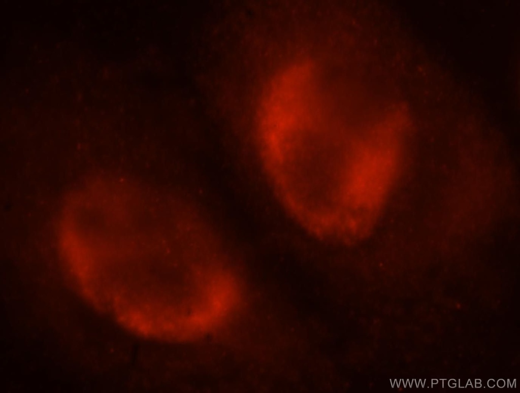 SNRPA1 Polyclonal antibody