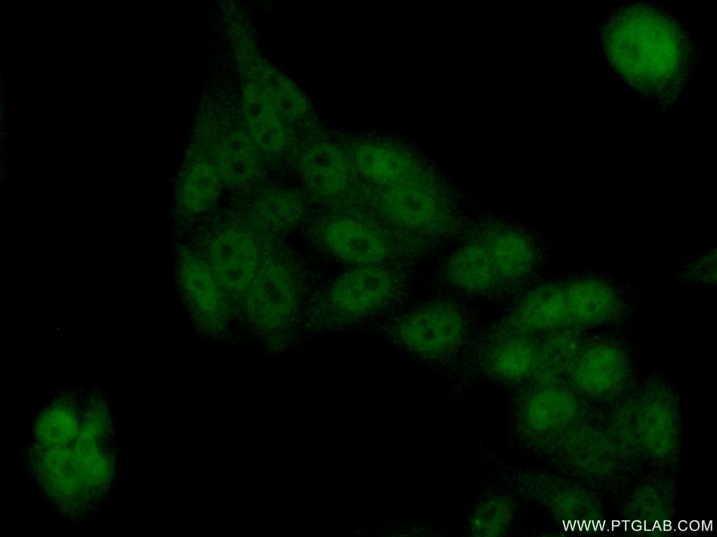 TEX10 Polyclonal antibody