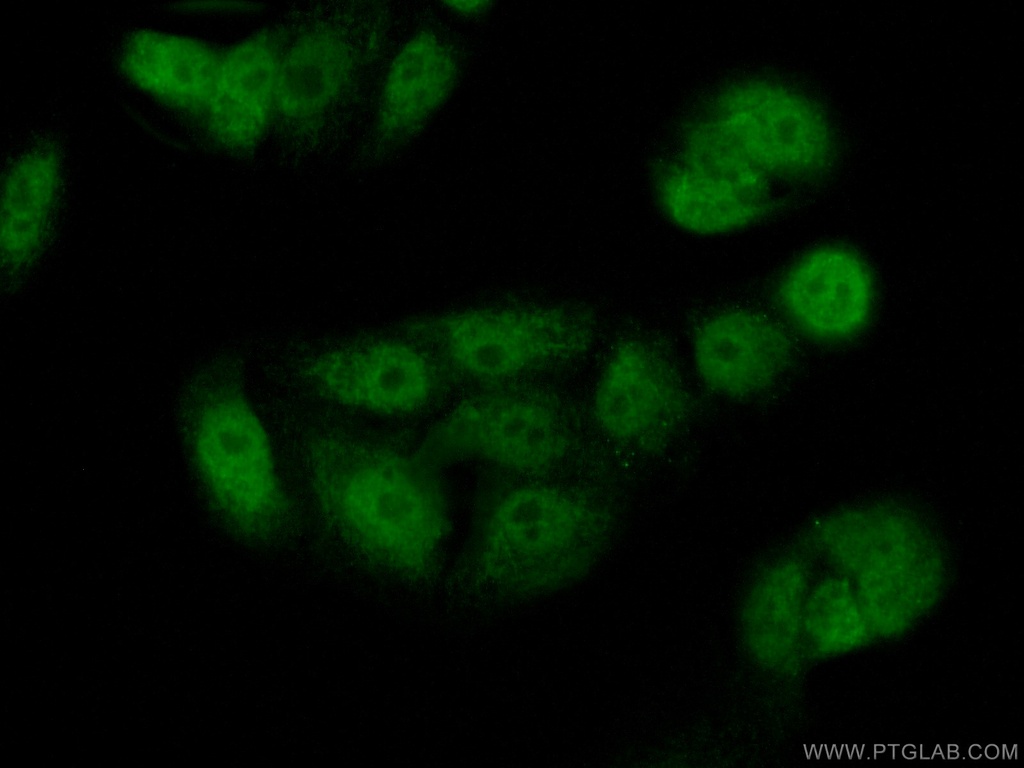 PADI4 Polyclonal antibody