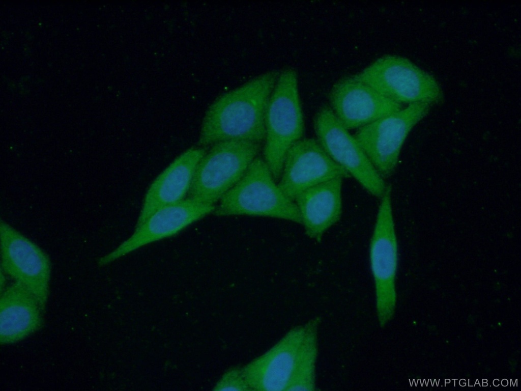 PIGZ Polyclonal antibody