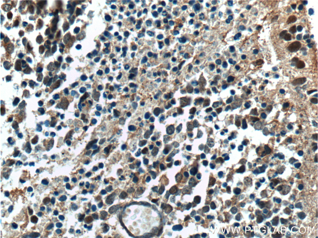 NRL Polyclonal antibody