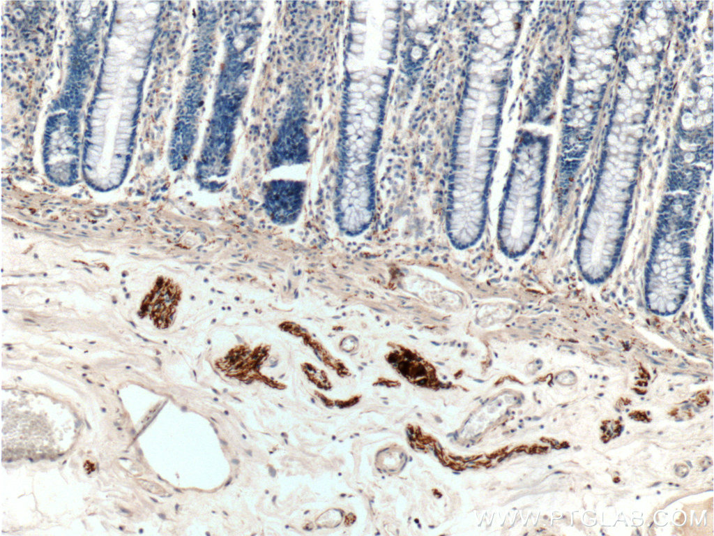 Peripherin Polyclonal antibody