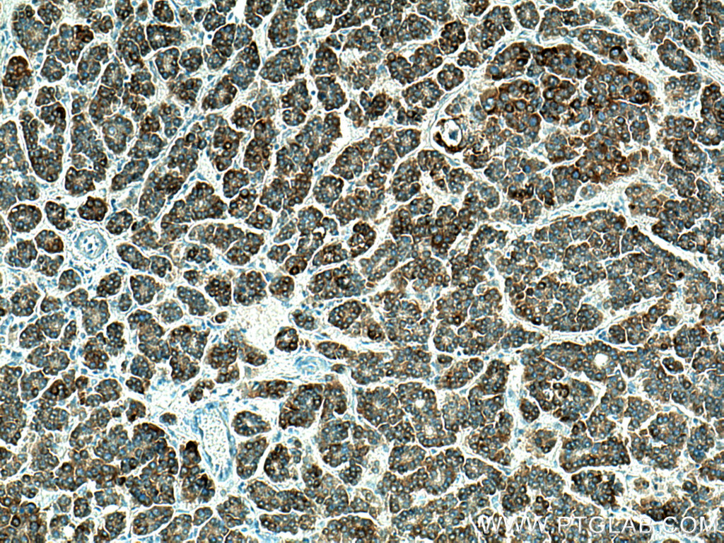 CXCL12/SDF-1 Polyclonal antibody