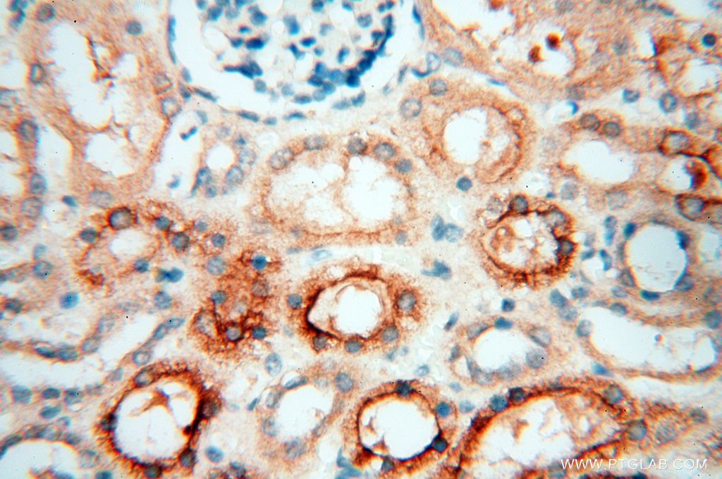 PDCL2 Polyclonal antibody