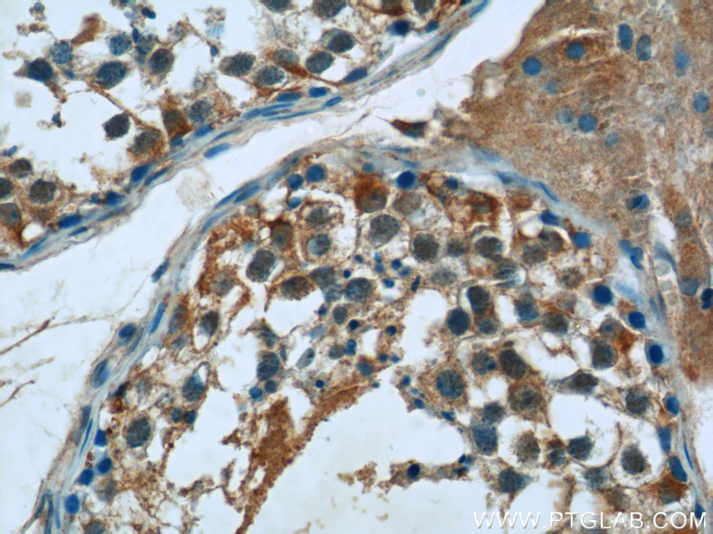 FJX1 Polyclonal antibody