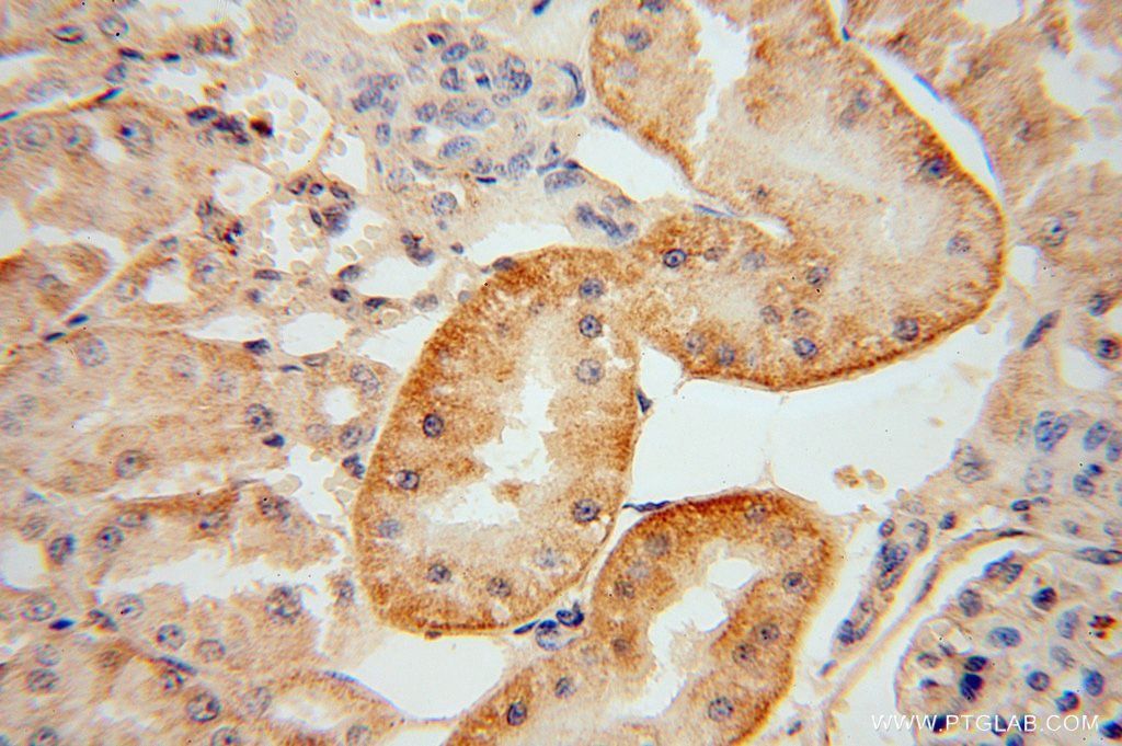 KIF26B Polyclonal antibody