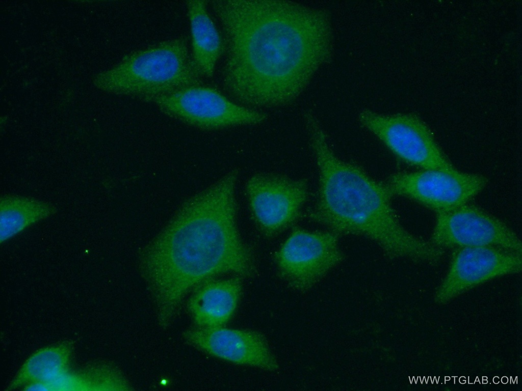 Leptin Polyclonal antibody