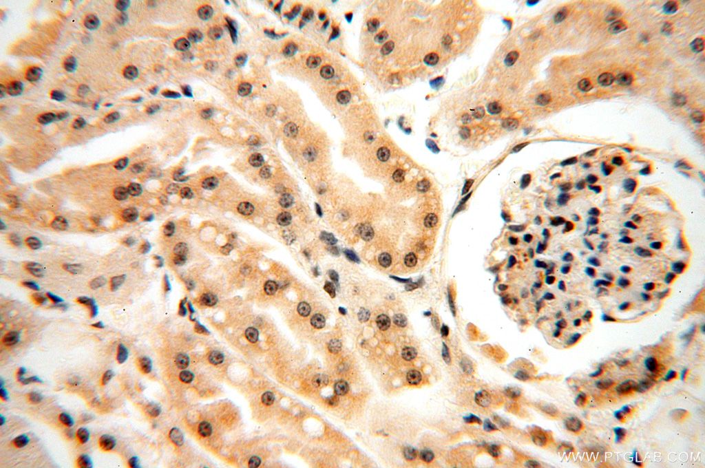 HDAC4 Polyclonal antibody