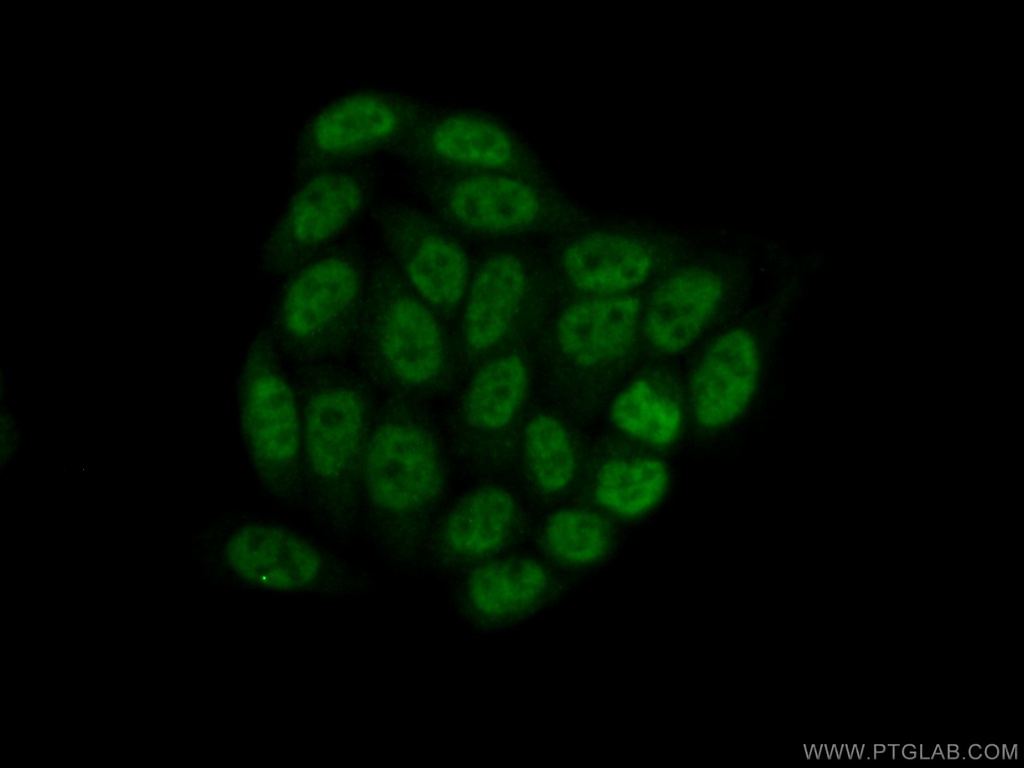 PPIL6 Polyclonal antibody