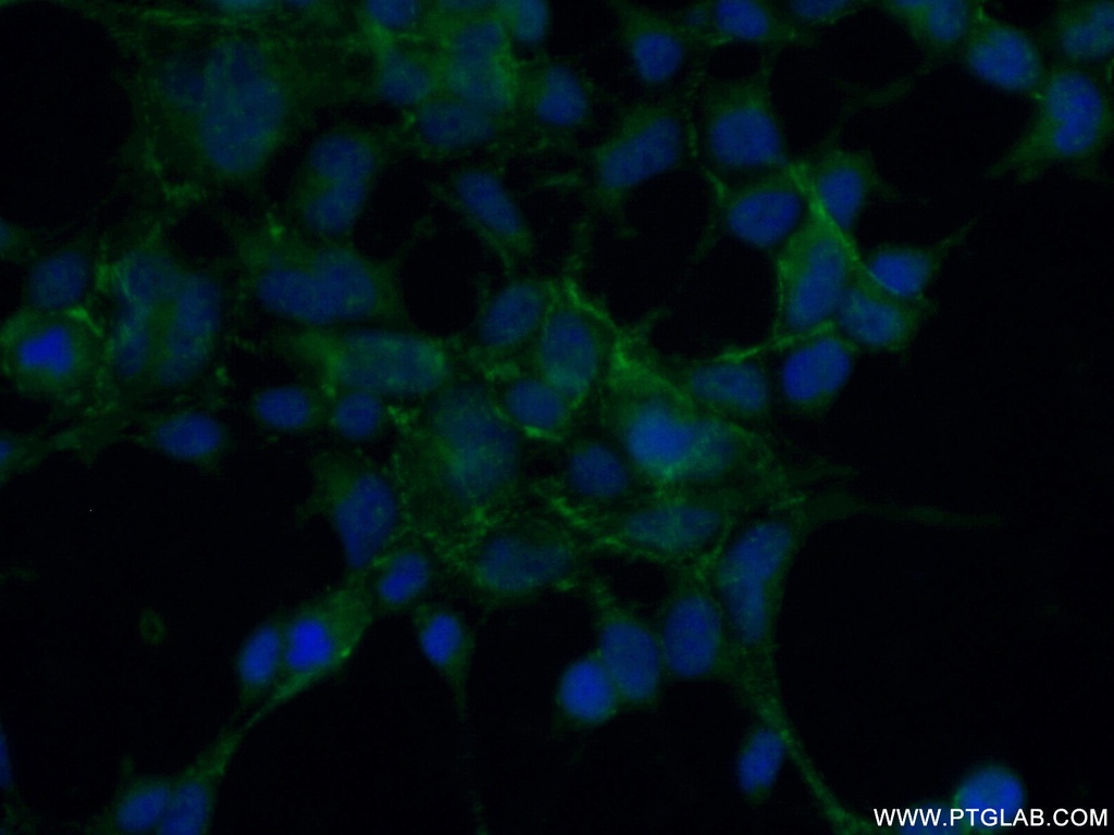 RTKN2 Polyclonal antibody