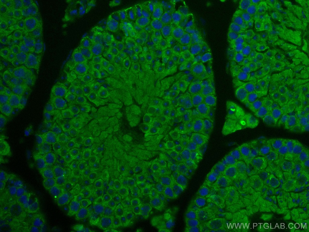 IFT140 Polyclonal antibody