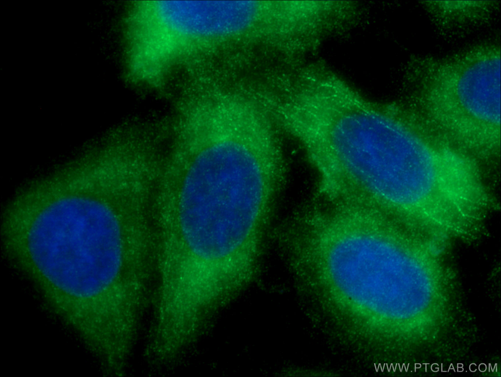 Plasminogen Polyclonal antibody