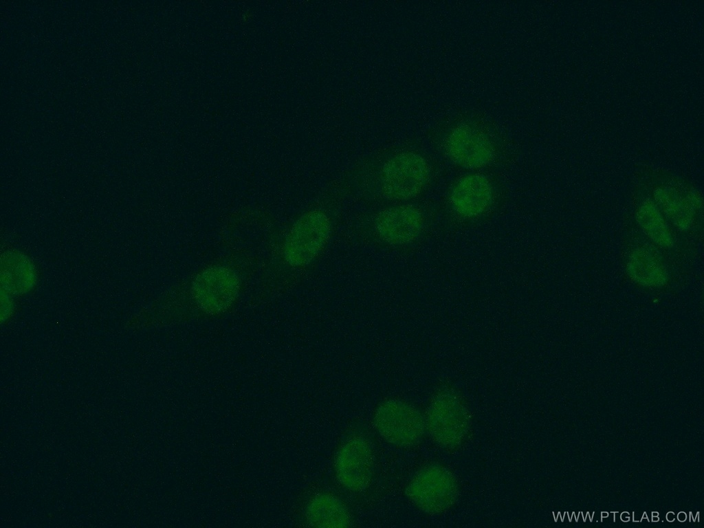 SKAR Polyclonal antibody