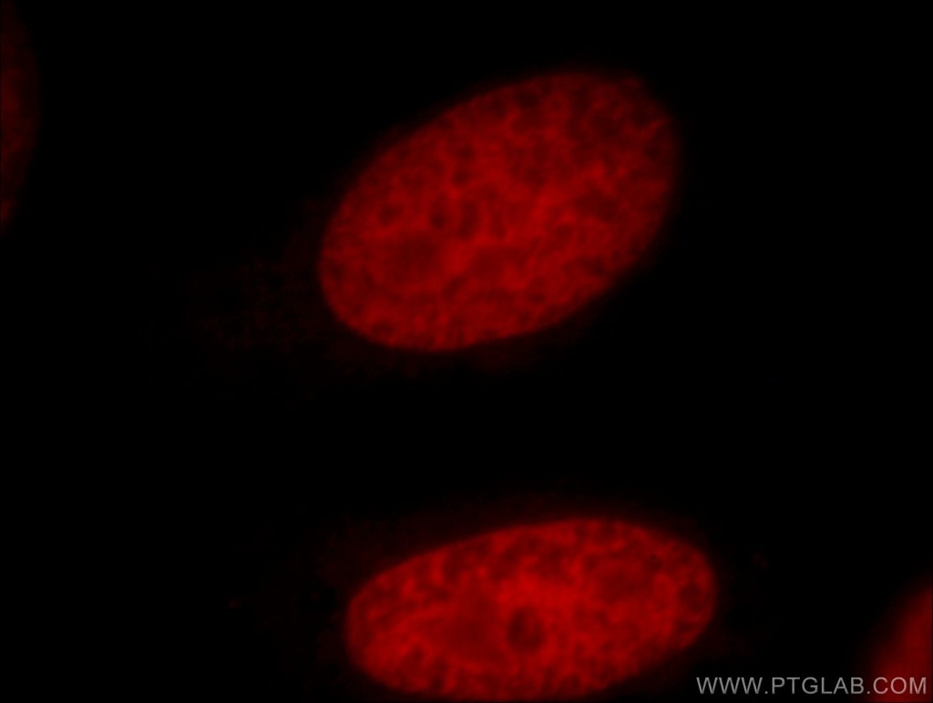 PDS5A Polyclonal antibody