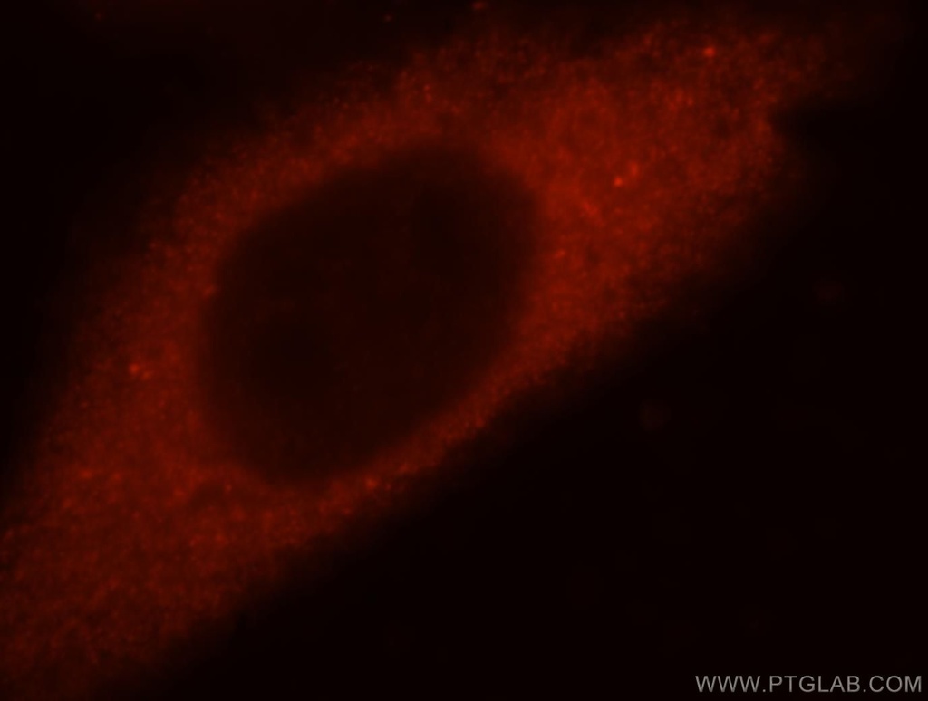 Filensin Polyclonal antibody
