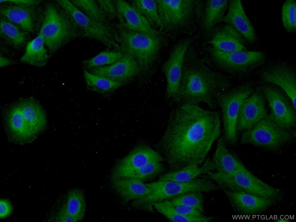 MAGEB18 Polyclonal antibody