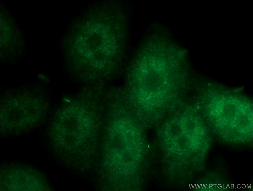 SPAG4L Polyclonal antibody